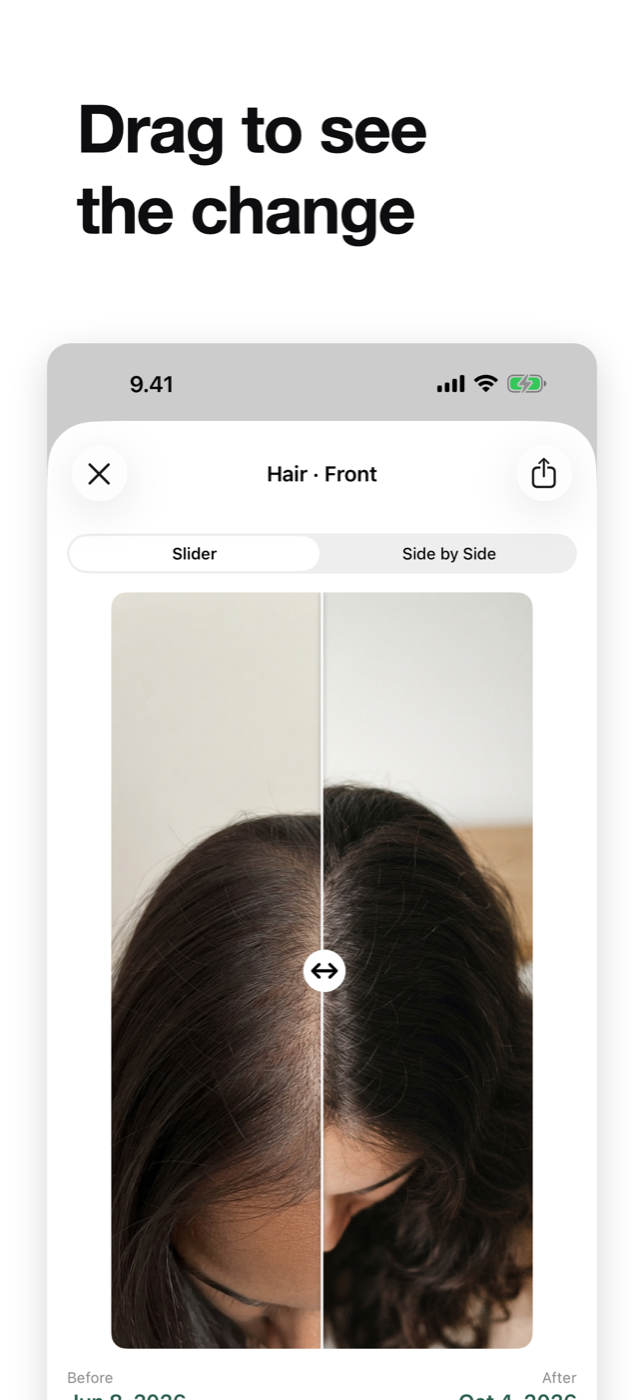 A before and after slider comparing two dates